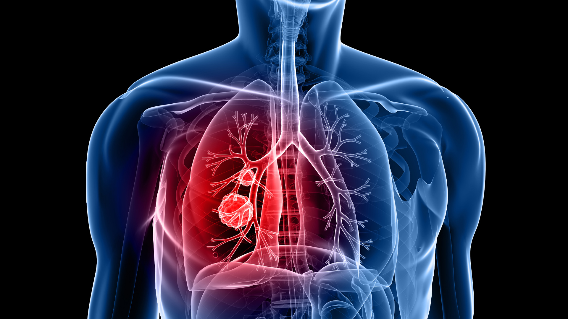 COPD Information